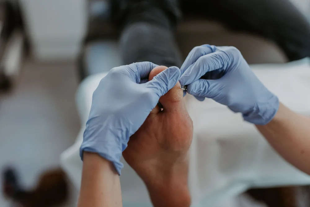 A podiatrist treating the skin on a patient's heel
