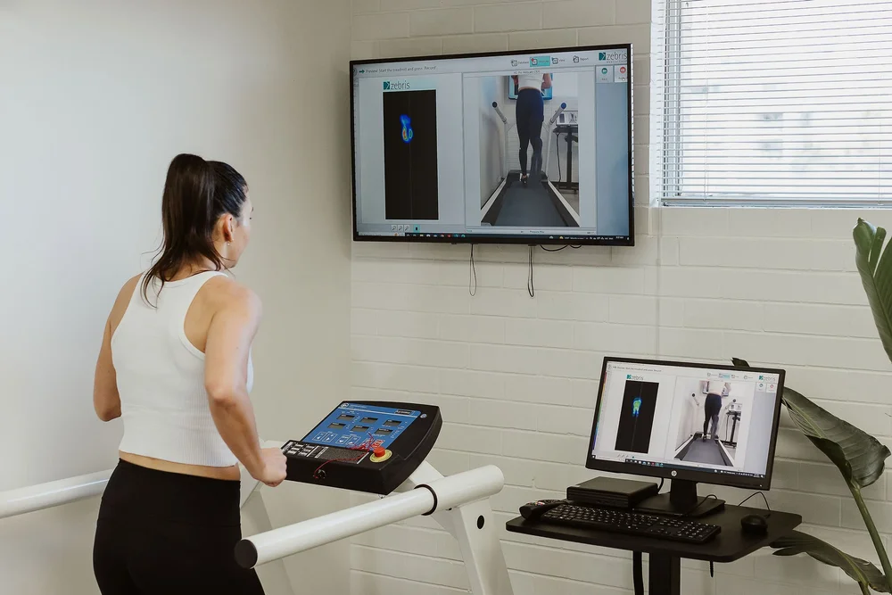A patient walking on the treadmill with gait analysis running on the screen behind