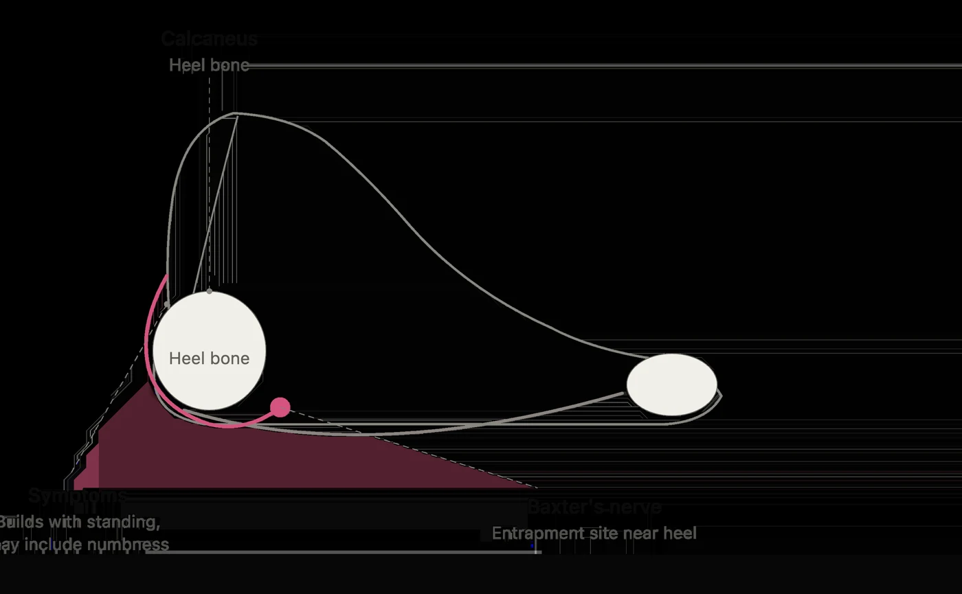 Heel anatomy diagram showing the path of Baxter's nerve