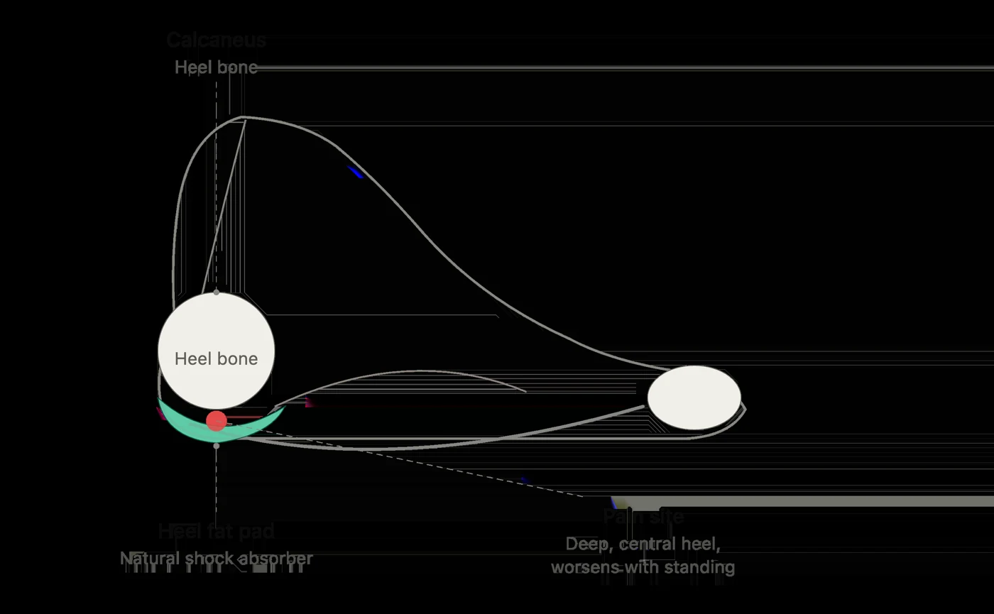 Heel anatomy diagram showing the fat pad beneath the heel bone